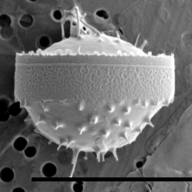 Chaetoceros constrictus SEM5