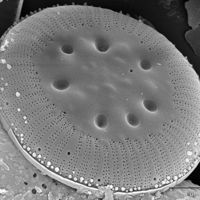 Cyclotella polymorpha SEM1