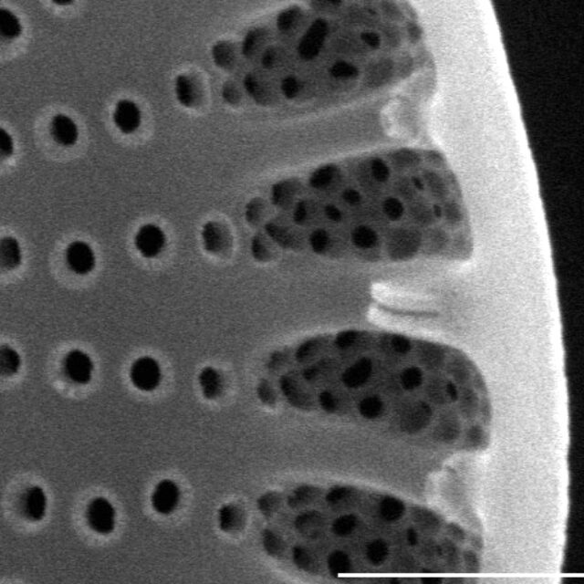 Cyclostephanos dubius SEM2