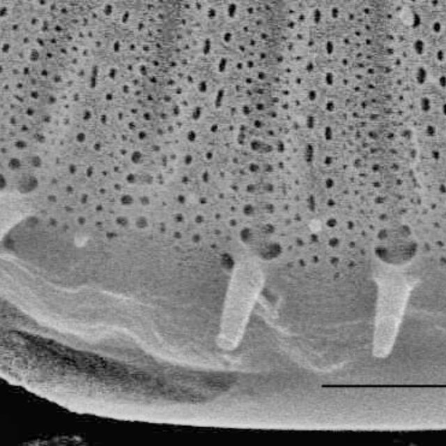 Cyclotella meneghiniana SEM1