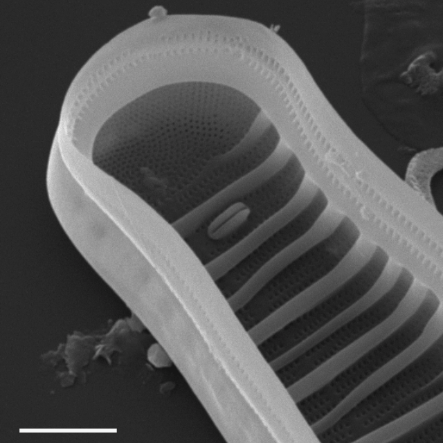 Diatoma ehrenbergii SEM2