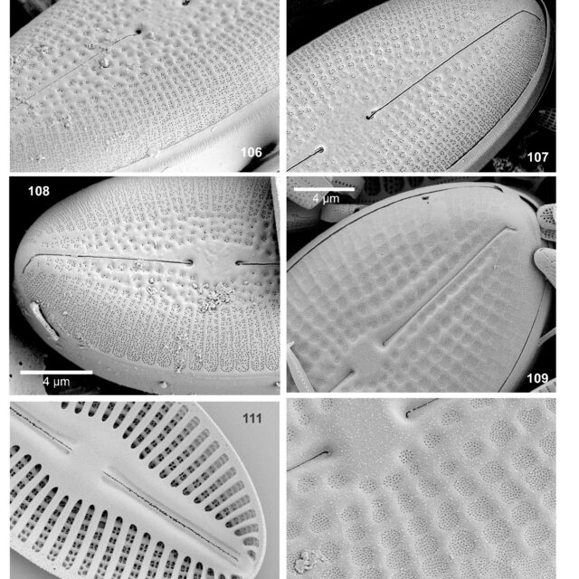 Diploneis Calcilacustris SEM