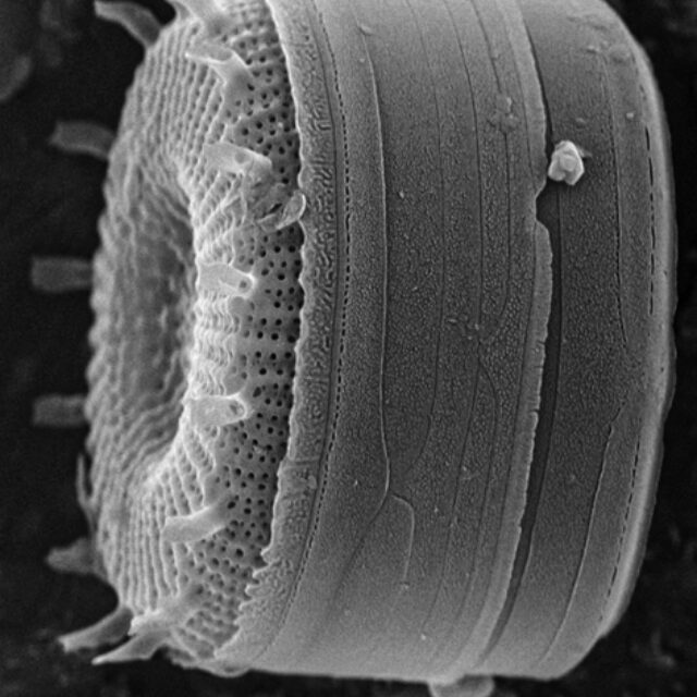 Discostella asterocostata SEM2