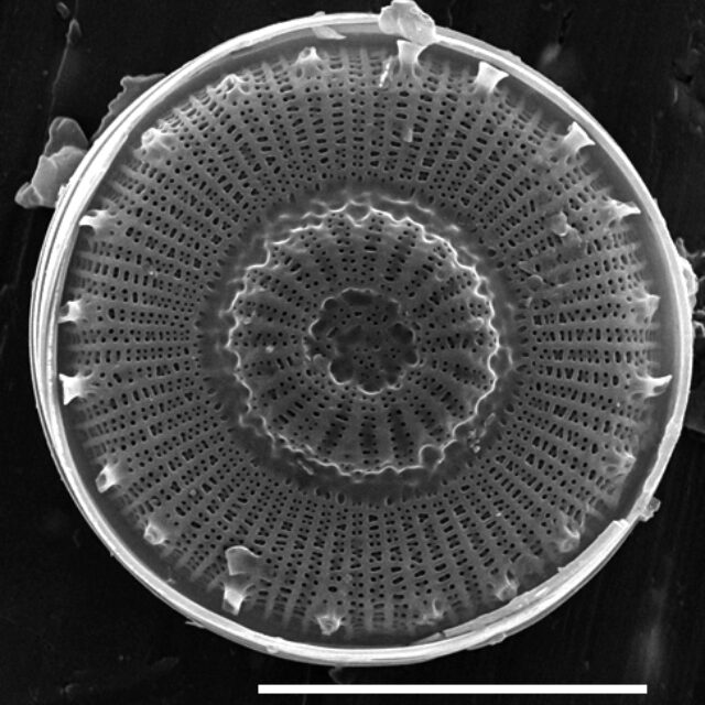 Discostella asterocostata SEM3 copy