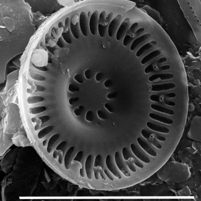 Discostella asterocostata SEM4 copy