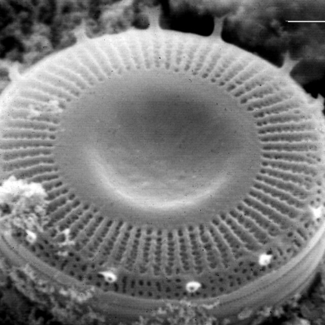 Discostella pseudostelligera  SEM1