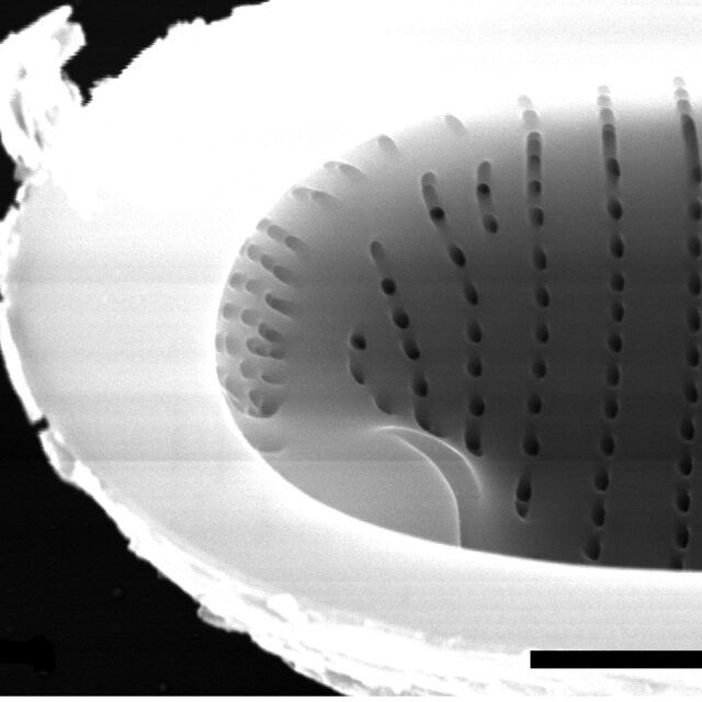 Eunotia areniverma SEM1