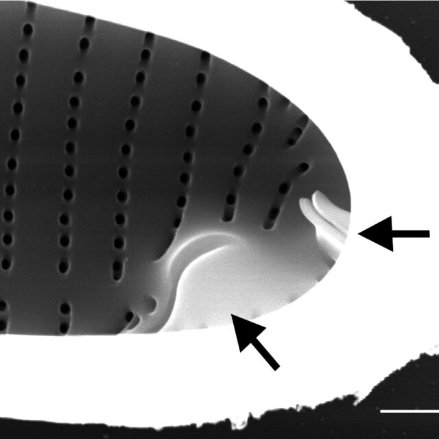 Eunotia areniverma SEM5