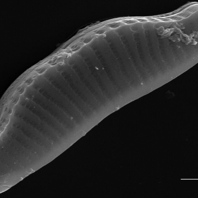 Eunotia kociolekii SEM4