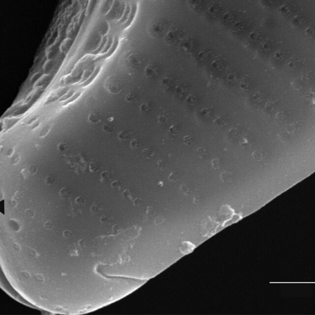 Eunotia kociolekii SEM2