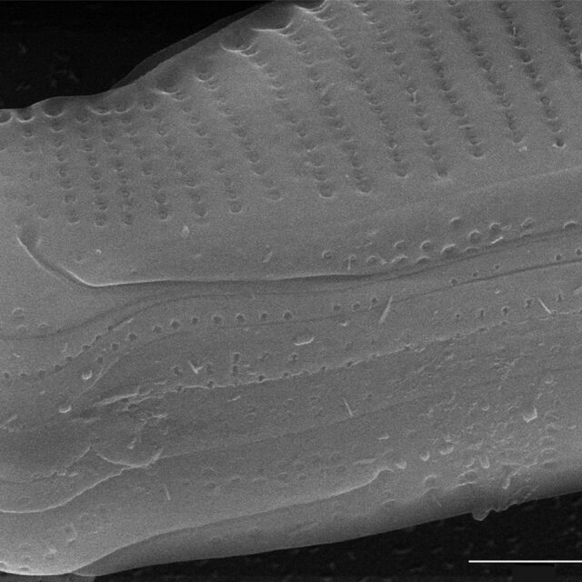 Eunotia kociolekii SEM3