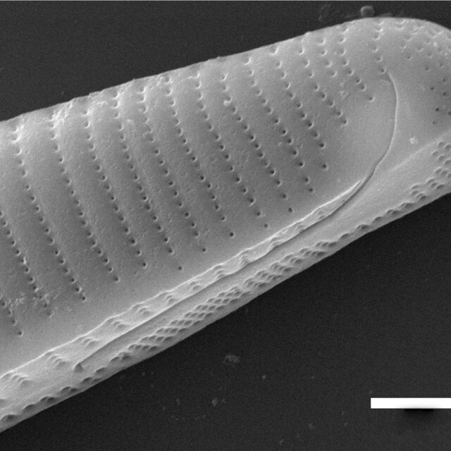 Eunotia macroglossa SEM2