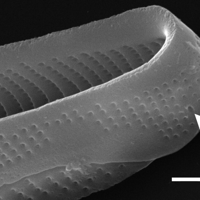 Eunotia macroglossa SEM3