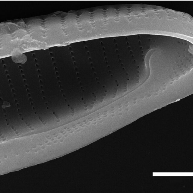 Eunotia macroglossa SEM4