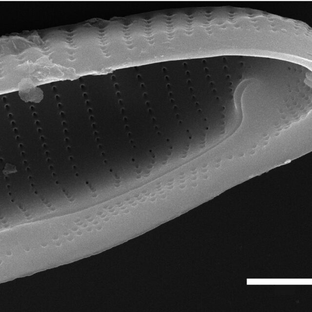 Eunotia macroglossa SEM5