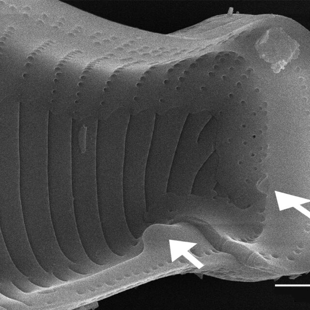 Eunotia montuosa SEM1