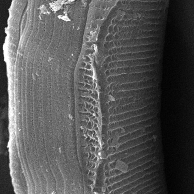 Eunotia montuosa SEM3