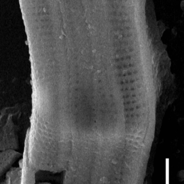 Achnanthes inflata SEM1