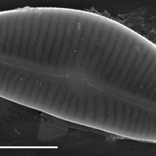 Encyonema hamsherae SEM3