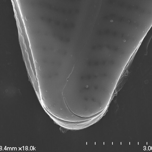 Encyonema hamsherae SEM4