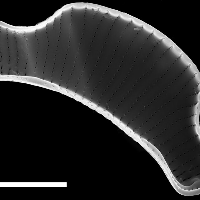 Eunotia Septentrionalis ANSP PF43 013