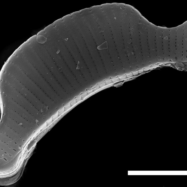 Eunotia Septentrionalis ANSP PF43 016