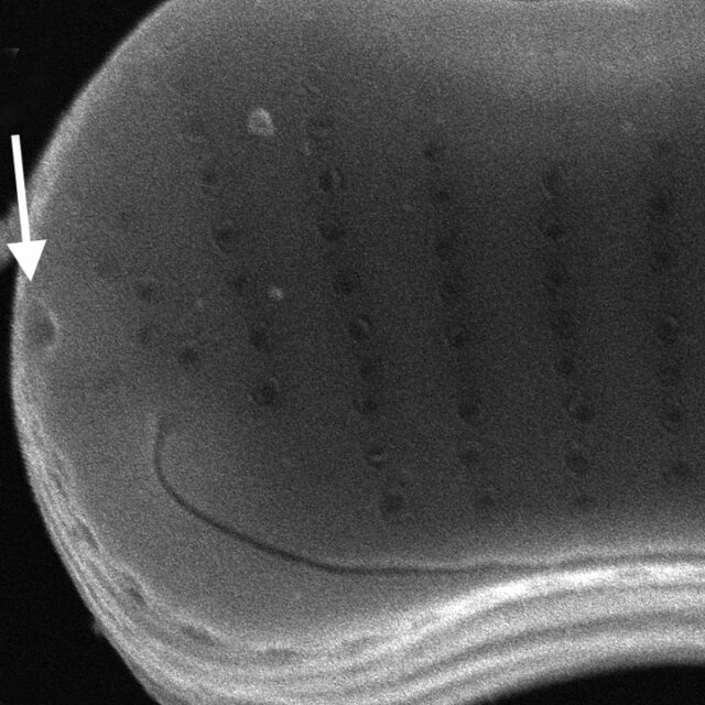 Eunotia cataractarum SEM3