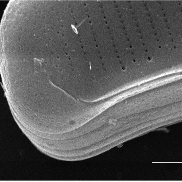 Eunotia richbuttensis SEM1