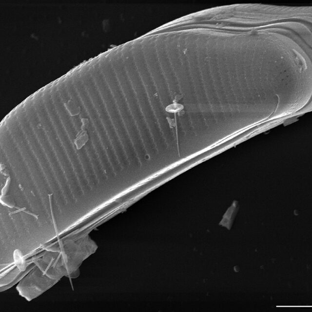 Eunotia richbuttensis SEM4