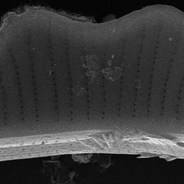 Eunotia subherkiniensis SEM1