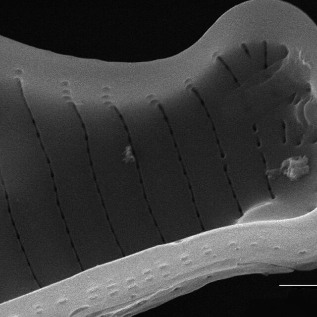 Eunotia subherkiniensis SEM2