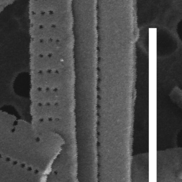 Fragilaria synegrotesca SEM1