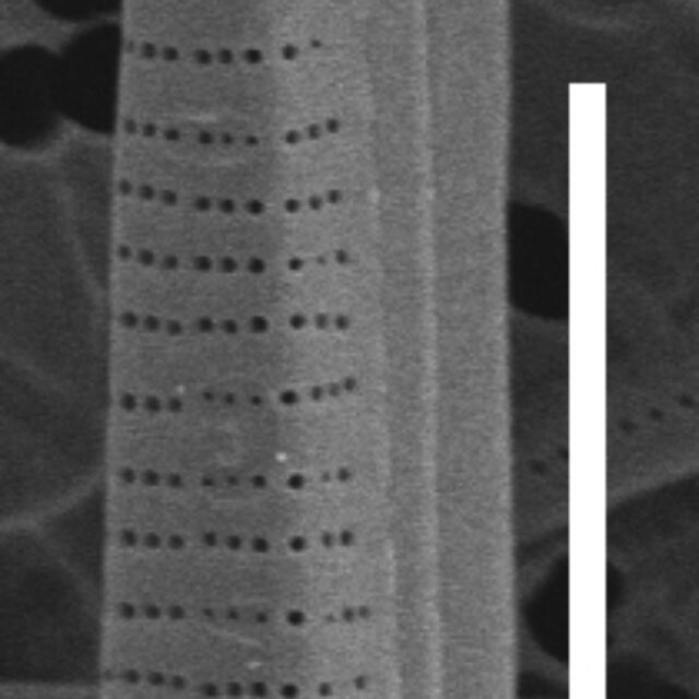 Fragilaria synegrotesca SEM2