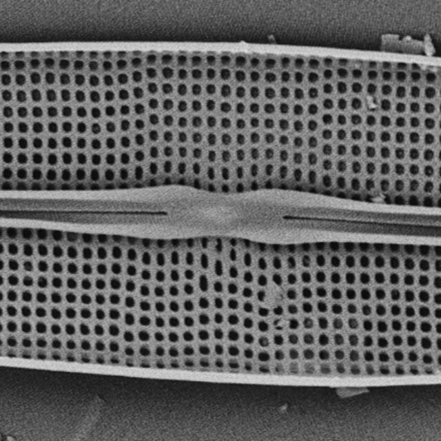 Frustulia pseudomagaliesmontana SEM1