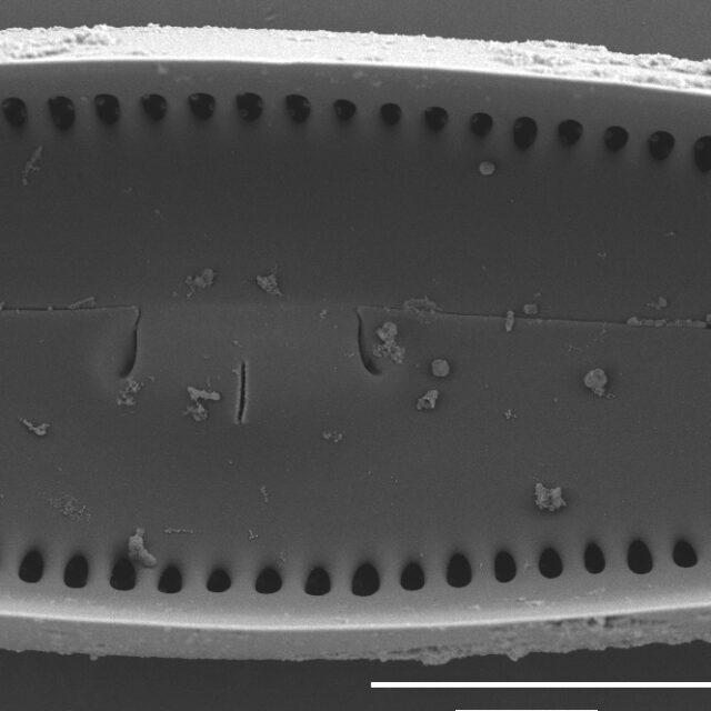 Gomphoneis oreophila SEM4