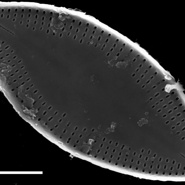 Nupela decipiens SEM1