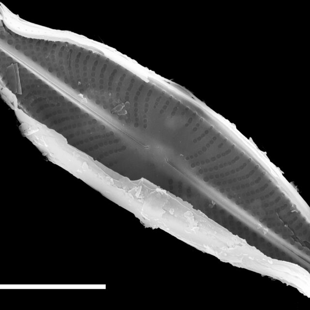 Sellaphora subfasciata SEM2