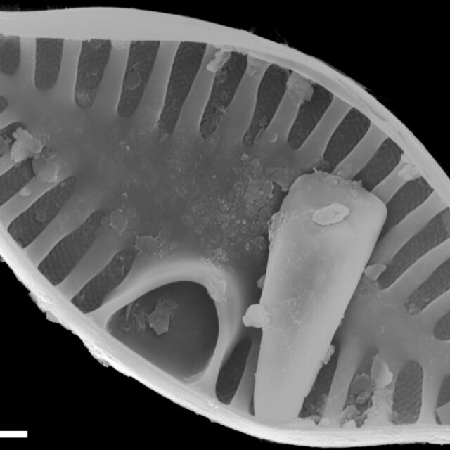 Planothidium abbreviatum SEM2