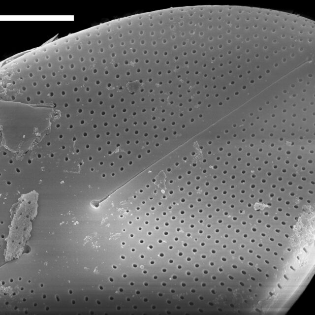 Cavinula maculata SEM1