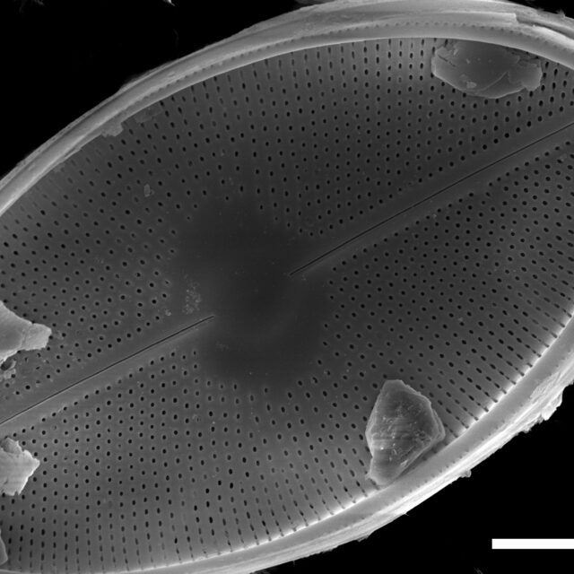 Cavinula maculata SEM2