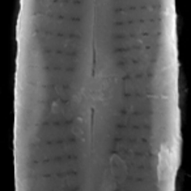 Achnanthidium duthiei SEM1