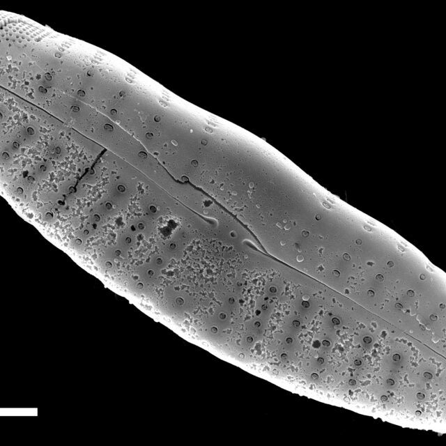 Reimeria uniseriata SEM1