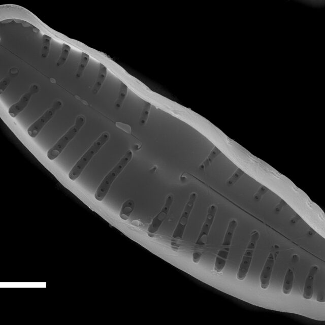 Reimeria uniseriata SEM3