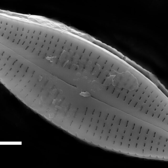 Achnanthidium alpestre SEM1