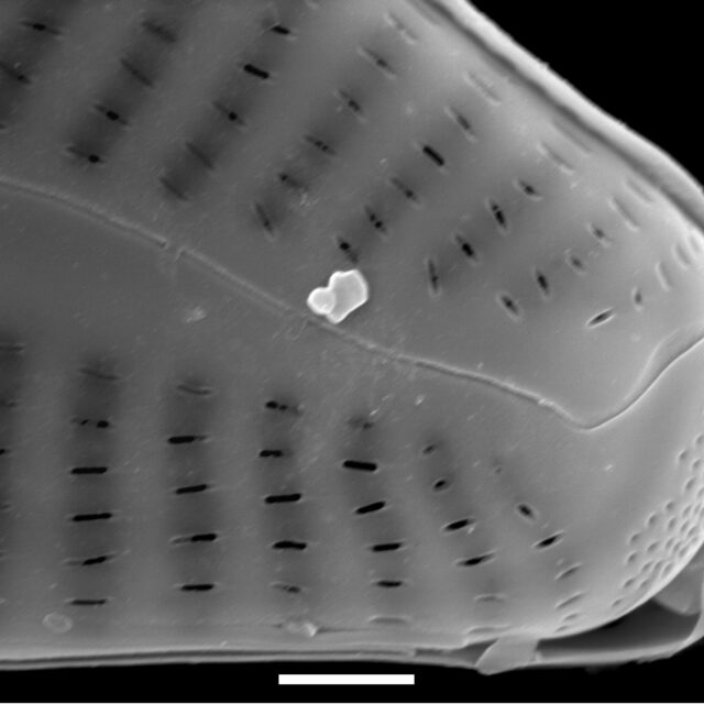 Cymbella tropica SEM3