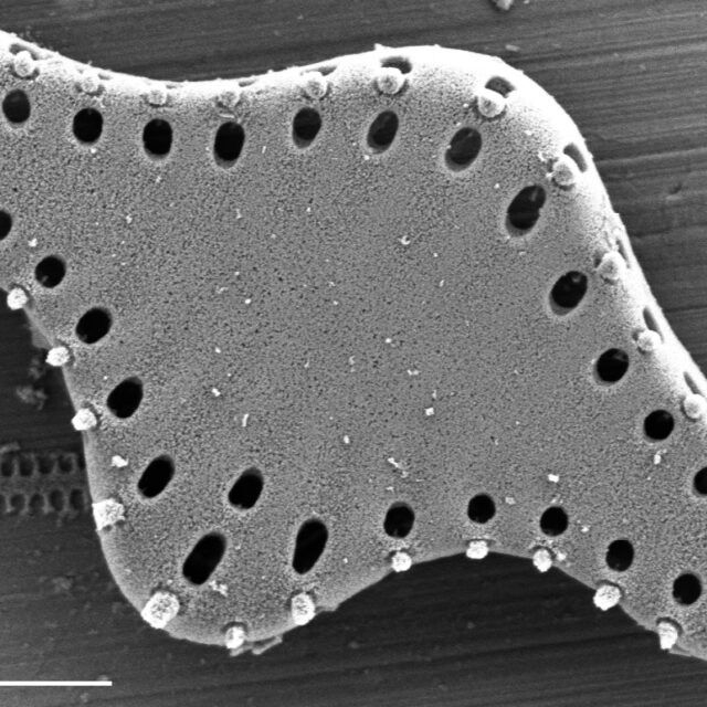 Pseudostaurosira pseudoconstruens SEM1