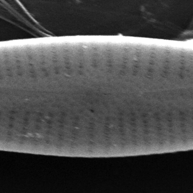 Gomphonema Intricatum Var Vibrio Sem1