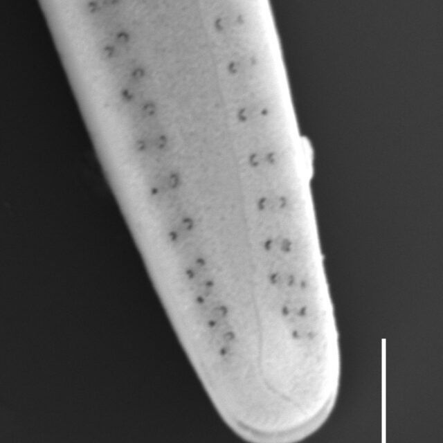 Gomphonema Intricatum Var Vibrio Sem3