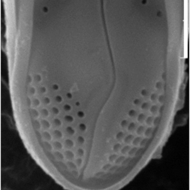 Gomphonema Incognito Img Sem Apical Pore Field