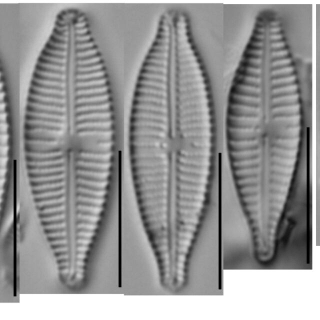 Gomphonema Parvulum Series 3